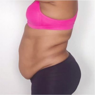Barriga Caída / Avental
