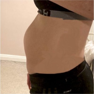 Barriga Estômago Alto