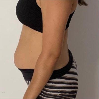 Barriga Pochete